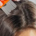 Pediculosi: cosa è e come risolvere